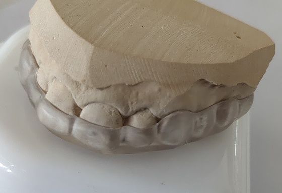 Στοματικό κομμάτι αψίδων Esthetics χαμηλότερο για το σφίξιμο δοντιών