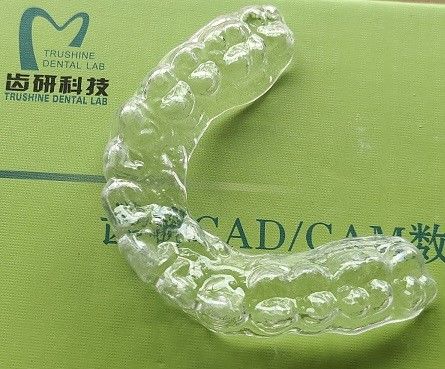 Occlusal άνετη στοματική φρουρά αψίδων ναρθήκων ανώτερη για Bruxism