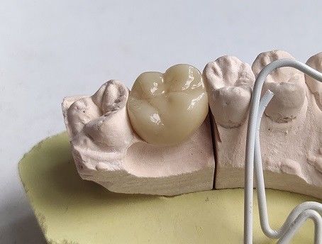 Κυβικά δόντια Zirconia πορσελάνης