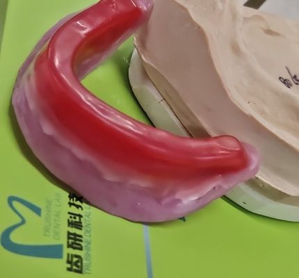 Οδοντικοί φραγμοί αρχείων Trushine για τις τελικές πλήρεις οδοντοστοιχίες
