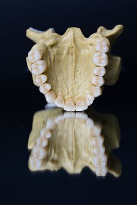 Οδοντική οδοντική κορώνα 5 αστέρια Esthetics Zirconia πορσελάνης εργαστηρίων